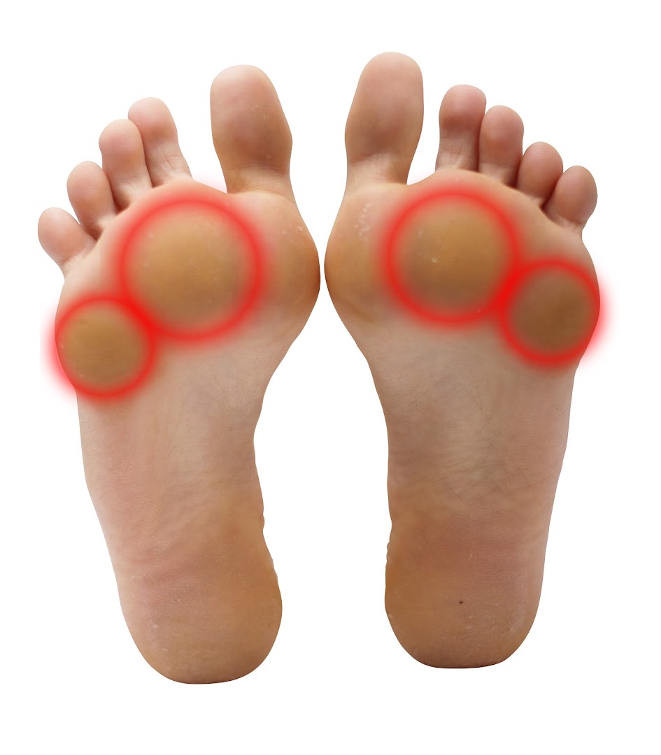 Step Forward Podiatry – Birkenhead