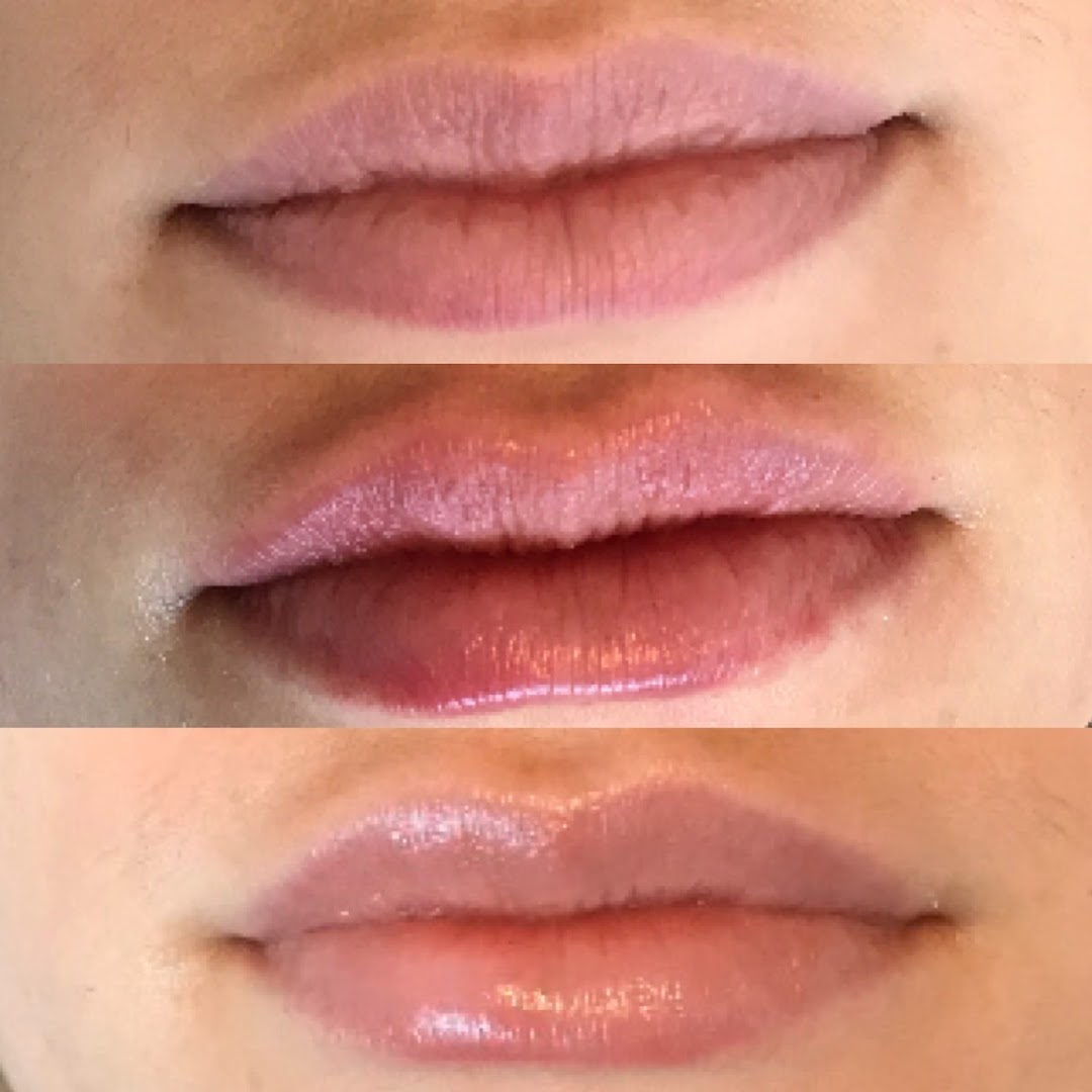 LIFT AESTHETICS – Camille Story, RN.