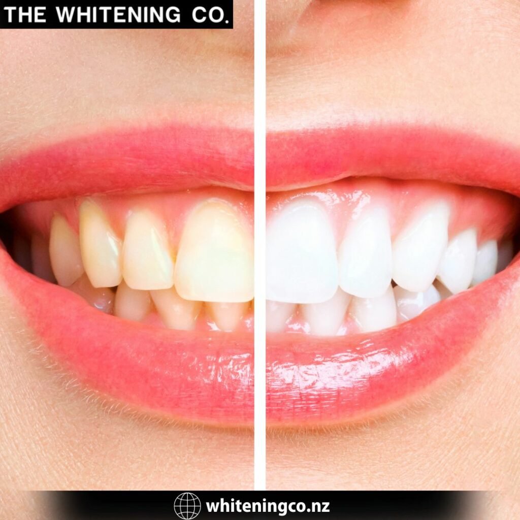 The Whitening Co. Studio Ponsonby